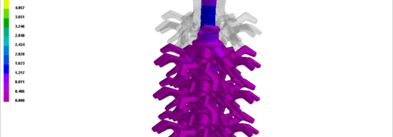 Optimizing Investment Casting Parameters for Enhanced Product Quality