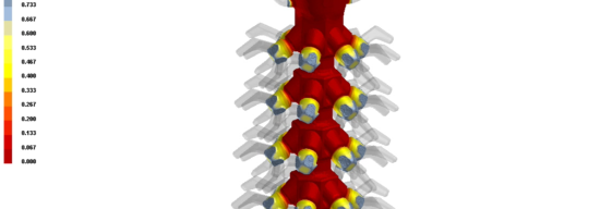 The Role of Simulation in Perfecting Investment Casting